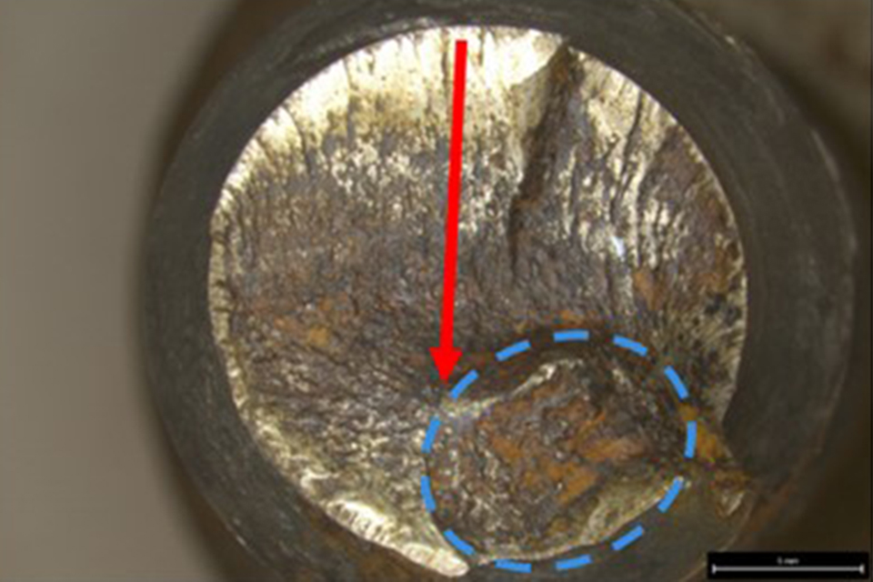  Fracture face of the upper portion of a recovered screw with indications of unidirectional high-cycle and low-cycle bending fatigue and a small area of overload (circled)